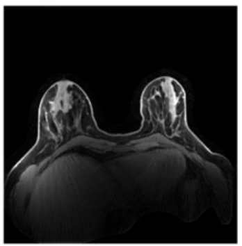 Tissue segmentation model preview