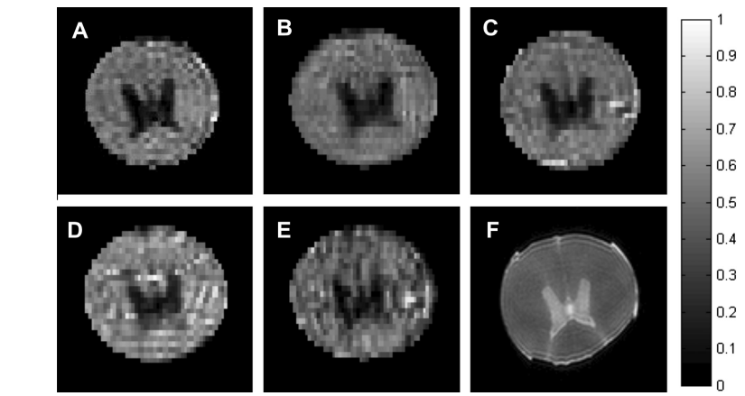 Diffusion weighted MRI by spatiotemporal encoding Analytical description and in vivo validations.png