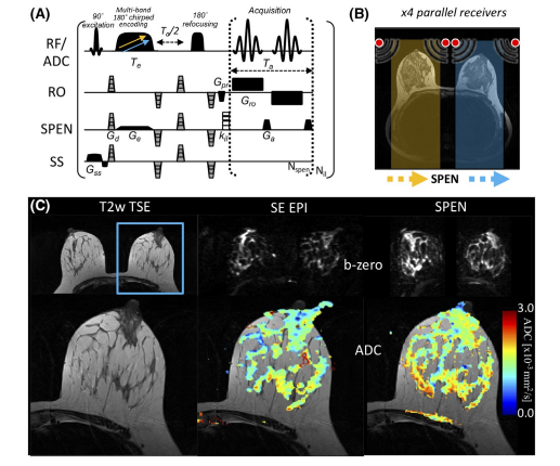 Diffusion-weighted breast MRI with SPEN encoding at submillimeter resolution