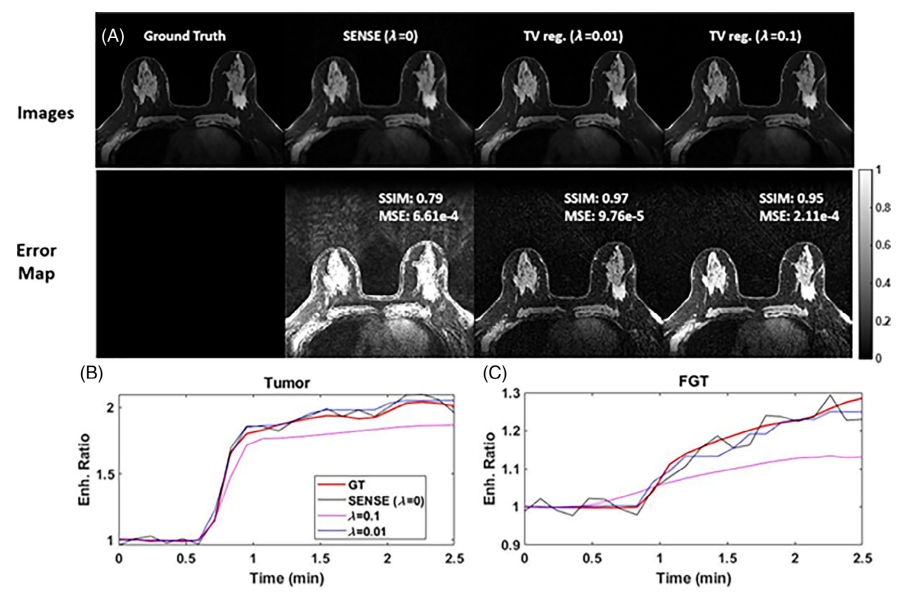 Digital reference object toolkit of breast DCE MRI for quantitative evaluation of image reconstruction and analysis methods.png