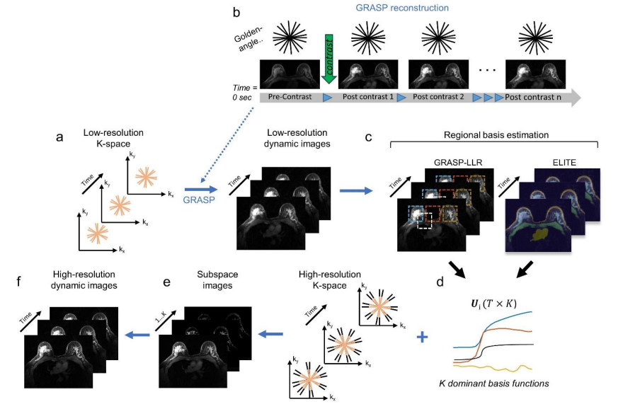 Dynamic MRI with Locally Low-Rank Subspace Constraint Towards 1-Second Temporal Resolution Aided by Deep Learning.png