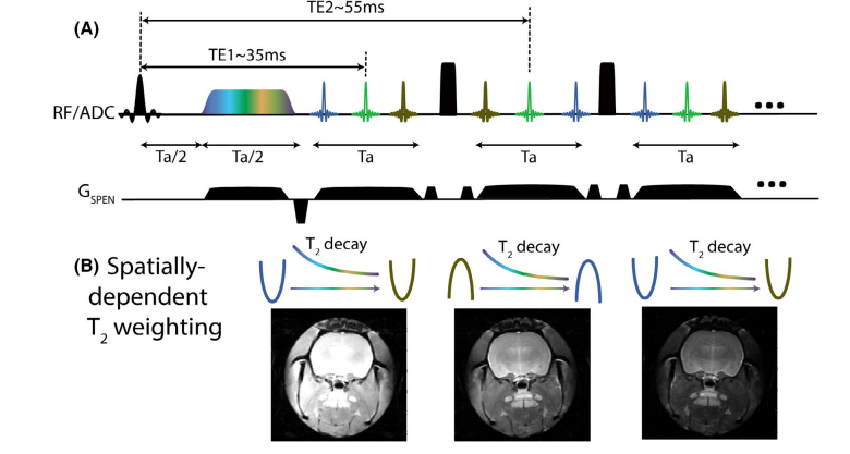 Dynamic T2 mapping by multi‐spin‐echo spatiotemporal encoding.png