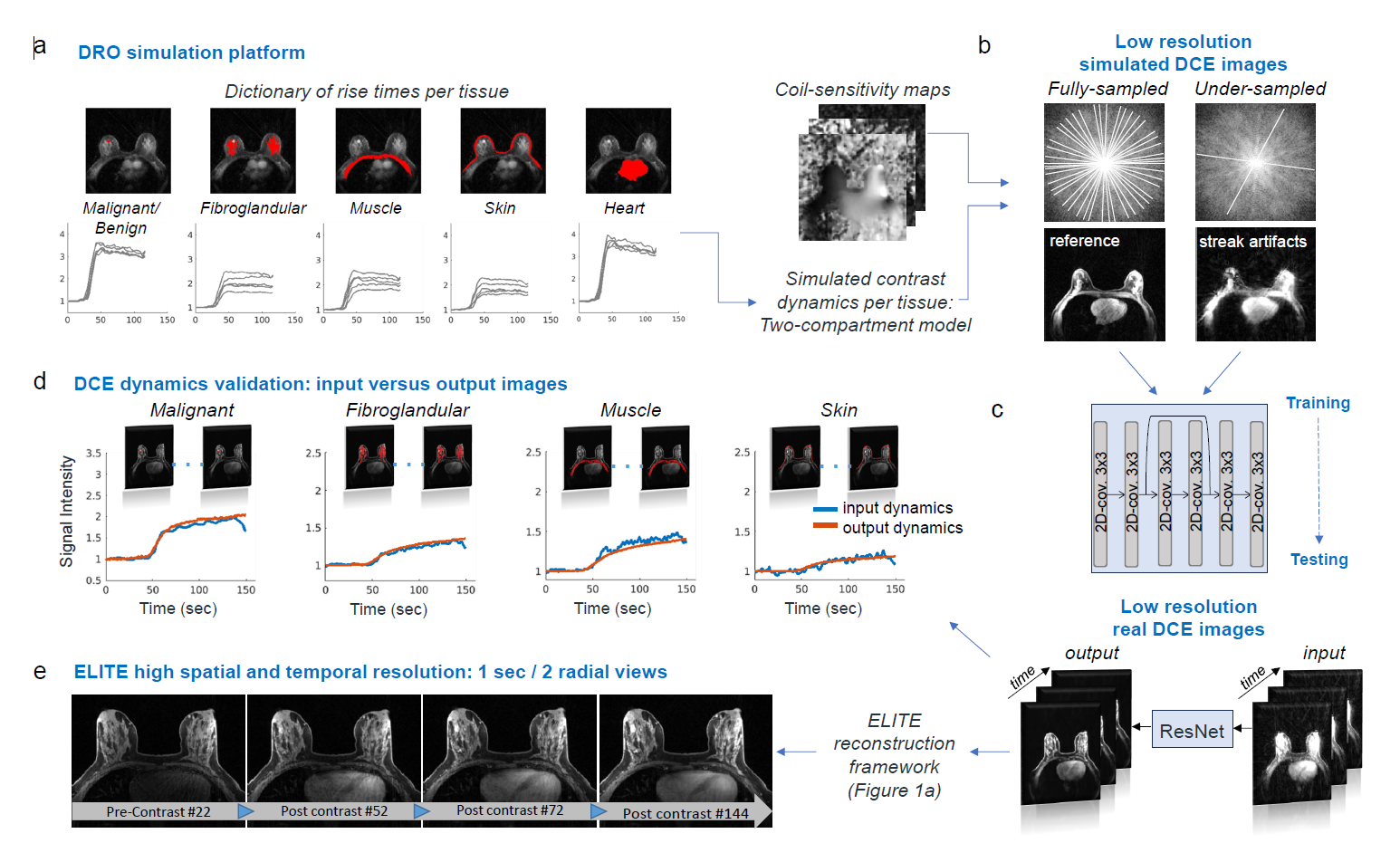 Dynamic breast MRI with Flexible Temporal Resolution Aided by Deep Learning.png