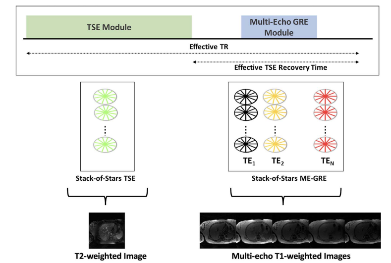 Free-Breathing Hybrid Technique for Simultaneous.png