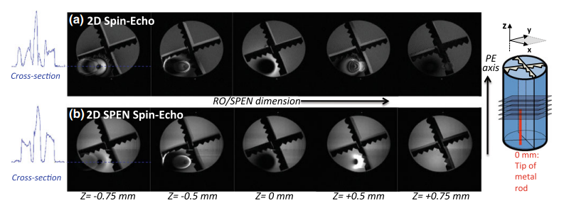 Fully refocused multi-shot spatiotemporally encoded MRI.png