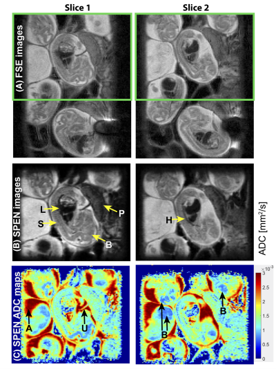High‐resolution diffusion MRI studies of development in pregnant mice visualized by novel spatiotemporal encoding schemes.png