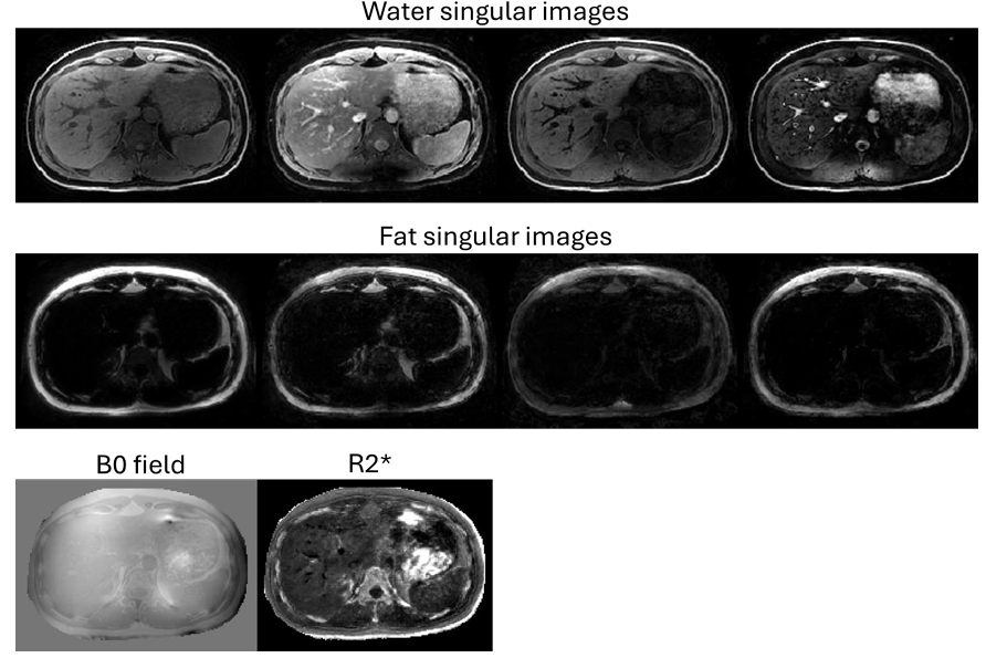 Implicit neural representation for free-breathing MR fingerprinting (INRMRF) .png