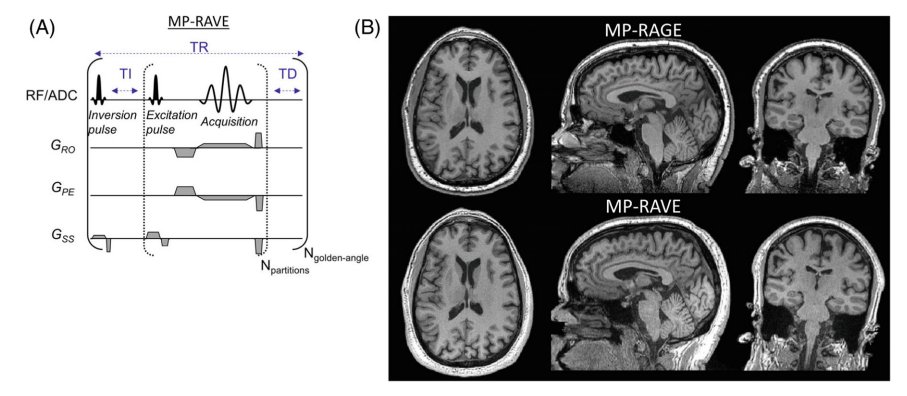 MP-RAVE IR-Prepared T1-Weighted Radial Stack-of-Stars 3D GRE imaging with retrospective motion correction.png