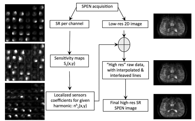 Multiple-Coil k-Space Interpolation Enhances Resolution.png