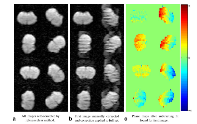 Referenceless Reconstruction of Spatiotemporally Encoded Imaging Data Principles and Applications to Real Time MRI.png