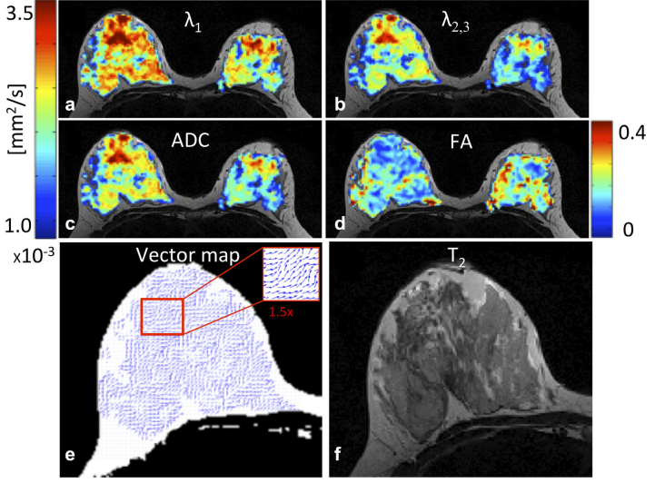 Robust Diffusion Tensor Imaging by Spatiotemporal Encoding Principles and In Vivo Demonstrations.png