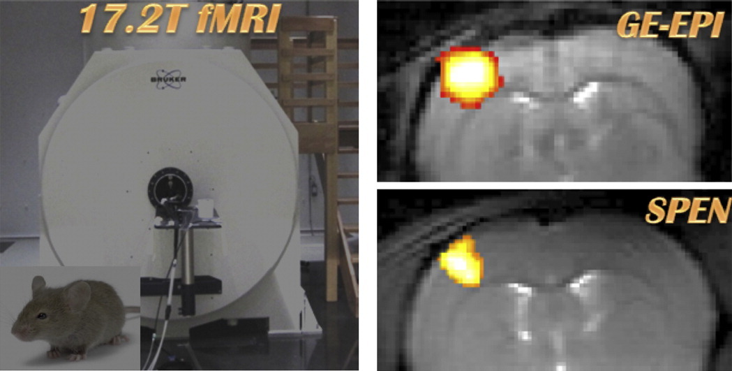 fMRI contrast at high and ultrahigh magnetic fields Insight from complementary methods.jpg